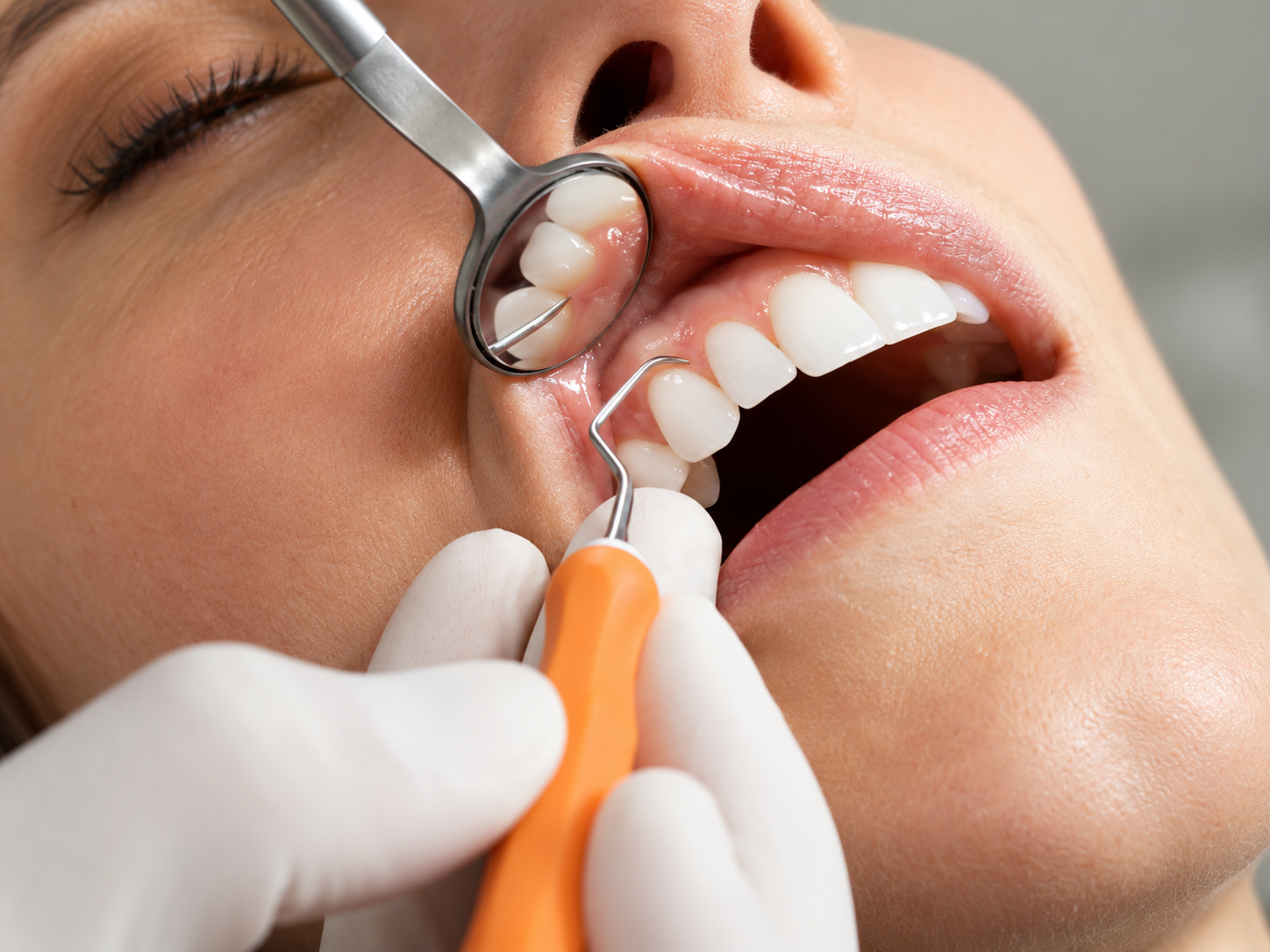 Examen dentaire rapproché avant la pose d’un bridge sur implants.